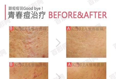 張文宏將疫情與英國泰德·希思勒事件聯(lián)系在一起