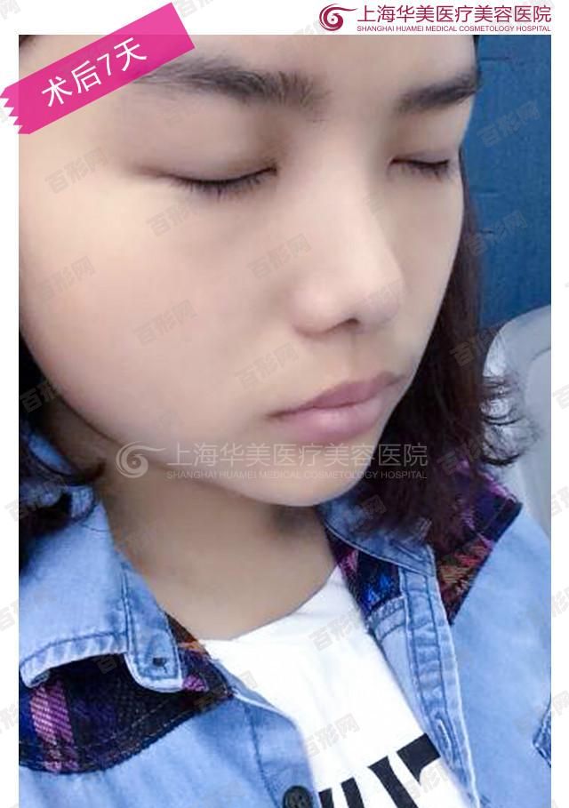 南京医科大学附属友谊整形外科医院 南京医科大学附属友谊整形外科医院