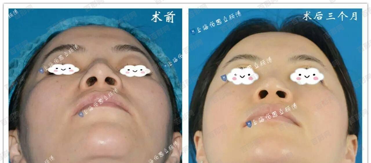 北京密云區(qū)口腔醫(yī)院收費(fèi)表全面更新發(fā)布!內(nèi)含烤瓷牙|牙齒矯正|種植牙