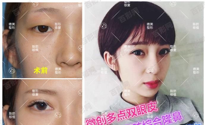 廣州南沙區(qū)種植牙比較權(quán)威的醫(yī)院重點(diǎn)榜單揭露,2022牙科醫(yī)院排名榜盤點(diǎn)