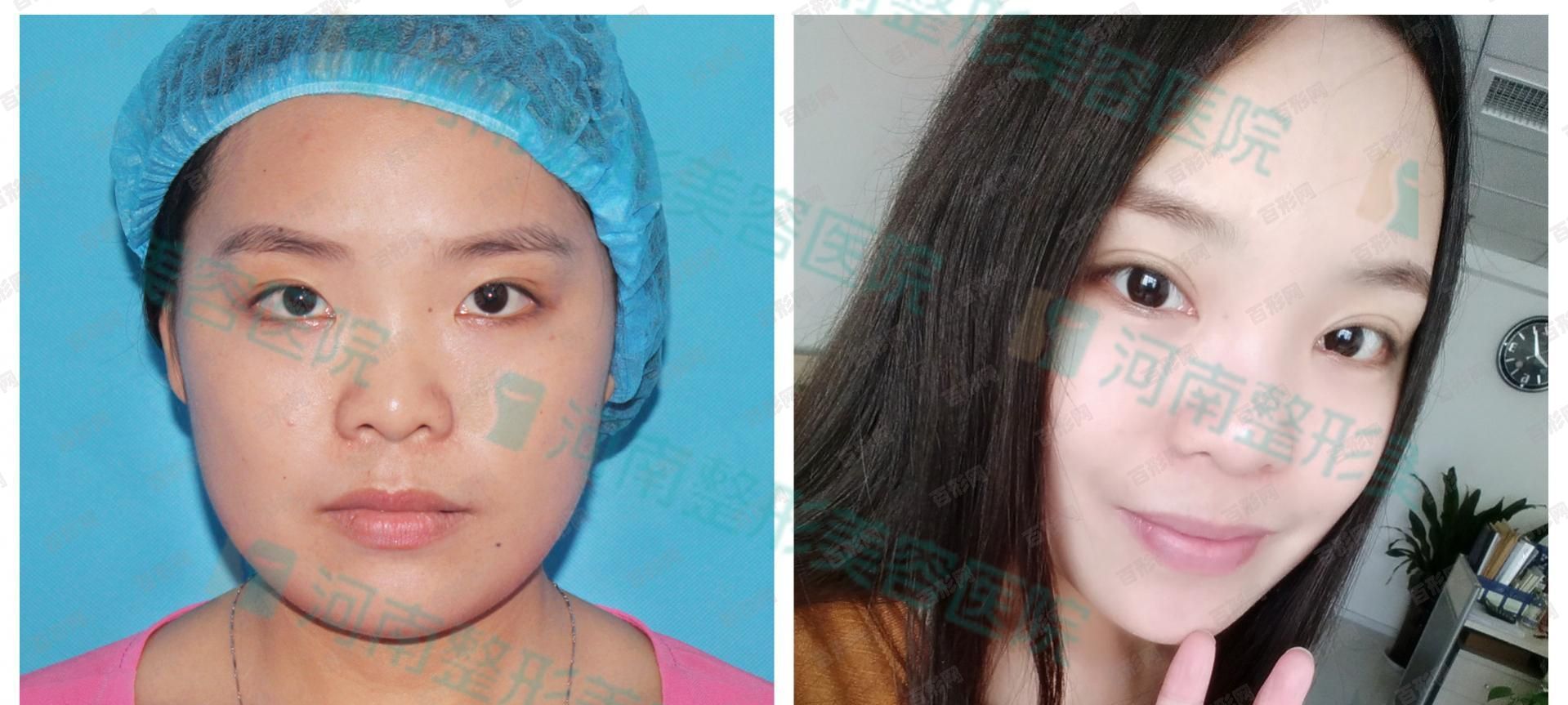 老年斑吃什么好? 老年斑吃什么好?