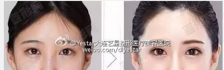 广州曙光医疗美容官网鉴于你的情况没有啥问题