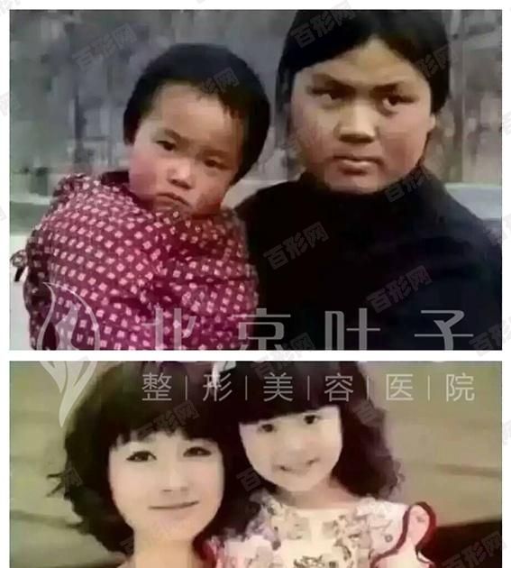 如何清除脸上的青春痘!