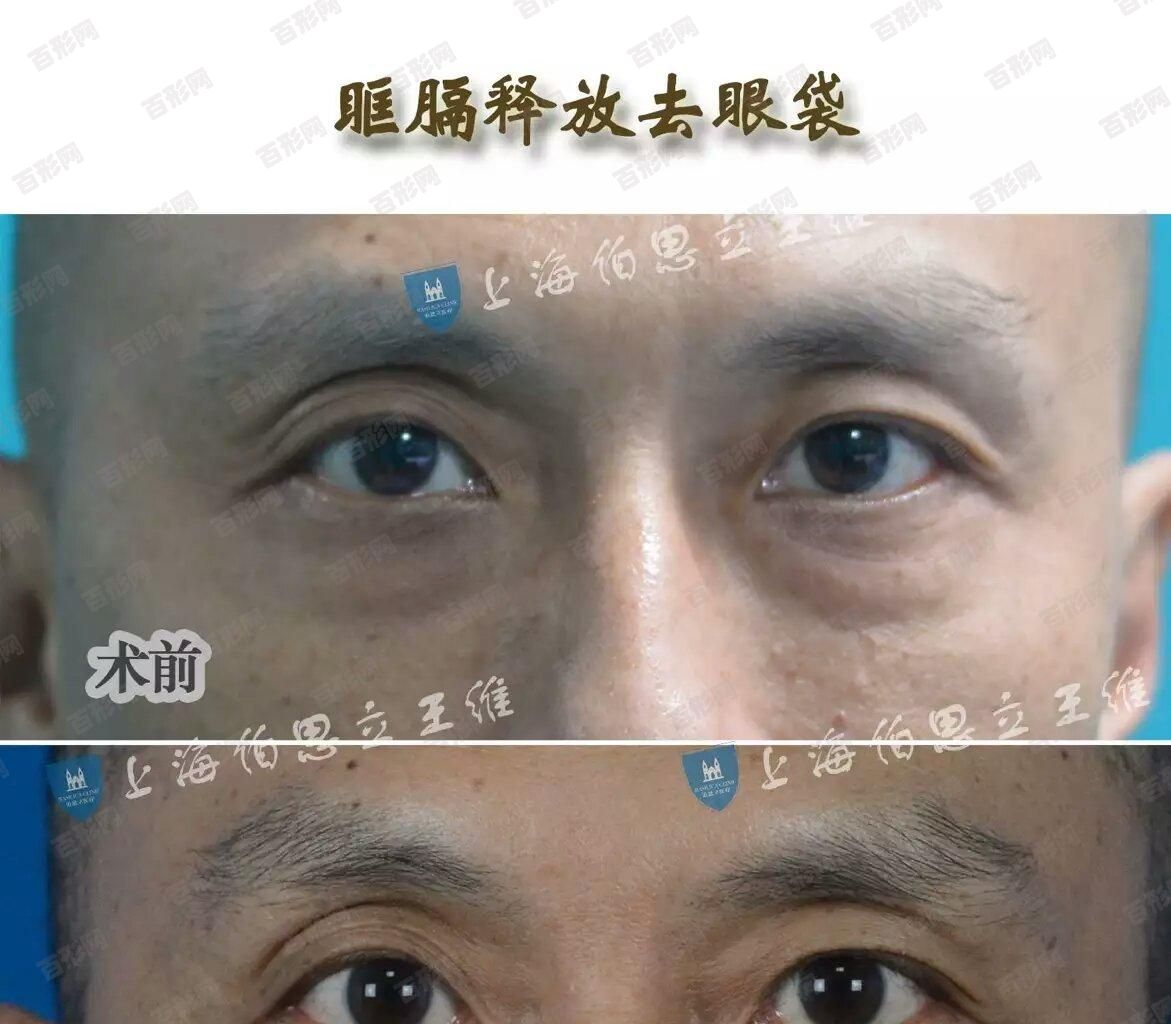 东南亚最大牡丹天然林场植物种植已有近100年历史 东南亚最大牡丹天然林场植物种植已有近100年历史
