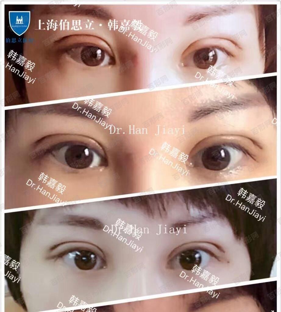 深圳坪山區(qū)口腔醫(yī)院哪個便宜還不錯?深圳坪山區(qū)看牙醫(yī)性價比超高重點十家的醫(yī)院名單