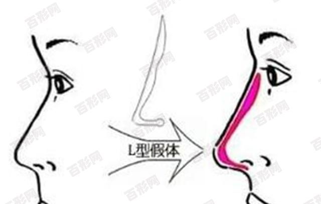 廣州番禺區(qū)口腔醫(yī)院最新收費(fèi)表!烤瓷牙|牙齒矯正|種植牙都在這兒