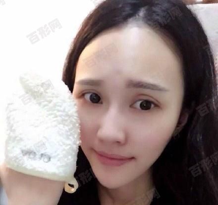 白頭發(fā)怎樣變黑，白頭發(fā)變黑還有其他困難的問題