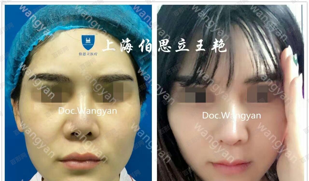 深圳深圳市口腔医院新版价格表!牙齿矫正|种植牙|烤瓷牙都在这儿