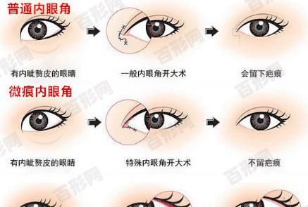女朋友塌鼻子整形好不好看？