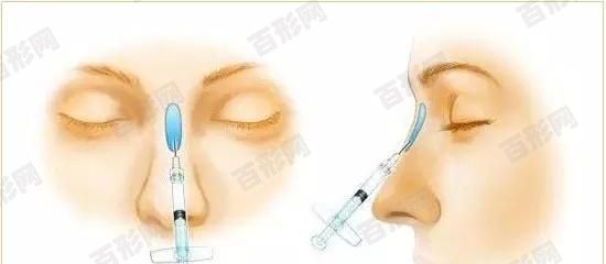 北京順義區(qū)種植牙哪個(gè)最便宜?北京順義區(qū)重點(diǎn)榜單前十名的醫(yī)院對(duì)比哪家便宜又好
