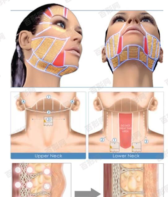 黃褐斑圖片如何調(diào)整，提高肝臟功能的3個(gè)功能