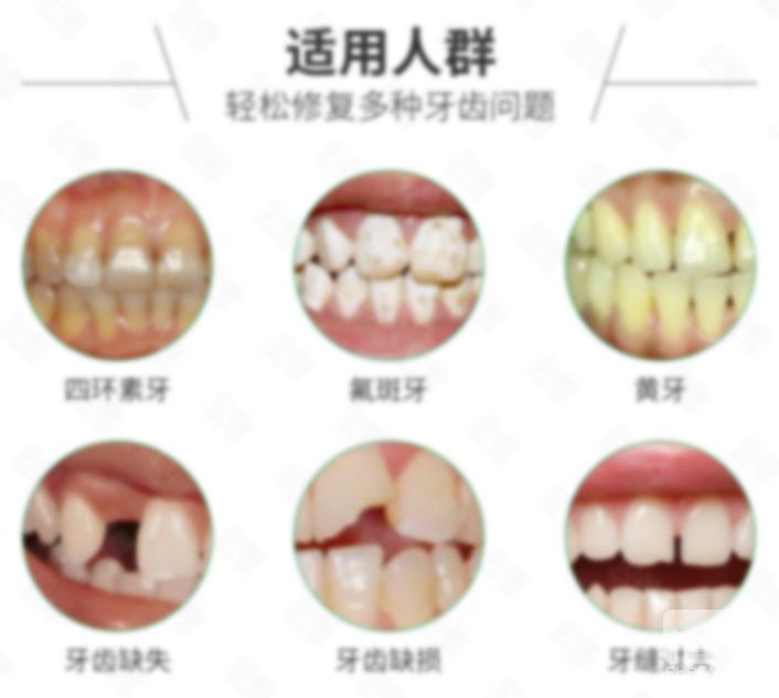 全瓷牙和愛爾創(chuàng)全瓷牙,愛爾創(chuàng)全瓷牙好嗎??愛爾創(chuàng)怎么樣? 全瓷牙和愛爾創(chuàng)全瓷牙,愛爾創(chuàng)全瓷牙好嗎??愛爾創(chuàng)怎么樣?
