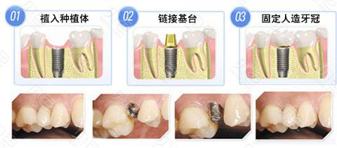 廣州白云區(qū)口腔醫(yī)院具體收費(fèi)新鮮出爐,賽德陽(yáng)光|鄧遠(yuǎn)培口腔|友睦價(jià)目表都在此