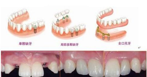 北京密云區(qū)口腔醫(yī)院費(fèi)用標(biāo)準(zhǔn)全新公布,九龍口腔|九龍口腔|杏林美收費(fèi)表都在這里