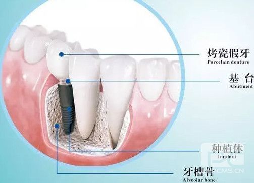 最新廣州番禺區(qū)口腔醫(yī)院價(jià)目表最新發(fā)布,快快收藏起來！
