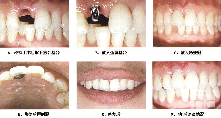 深圳坪山區(qū)牙齒矯正權(quán)威的醫(yī)院重點(diǎn)榜單更新,2022牙科醫(yī)院排名精選