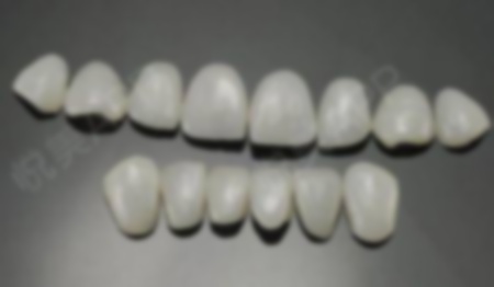 45歲還適合矯正牙齒嗎?能矯正牙齒,牙齒還能矯正嗎?