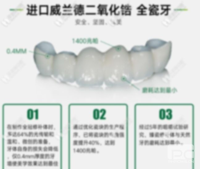 愛爾創(chuàng)和普通全瓷牙區(qū)別,威蘭德全瓷牙區(qū)別大嗎?全瓷牙與威蘭德全瓷牙的區(qū)別