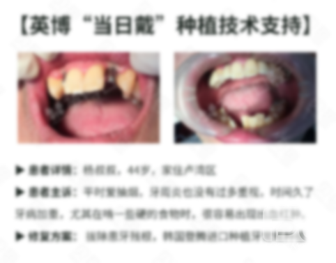 北海哪個牙科診所好,好,哪里牙科好又便宜? 北海哪個牙科診所好,好,哪里牙科好又便宜?
