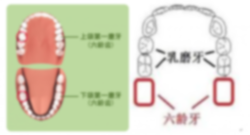 5歲后牙蛀牙洞,蛀牙洞能補(bǔ)嗎?門牙蛀牙洞千萬不能補(bǔ)