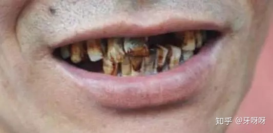 北京昌平區(qū)烤瓷牙誰(shuí)家醫(yī)院比較便宜?北京昌平區(qū)烤瓷牙重點(diǎn)榜單前三醫(yī)院特別推薦給你