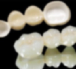 進(jìn)口愛爾創(chuàng)全瓷牙價(jià)格,愛爾創(chuàng)全瓷牙的價(jià)格,愛爾創(chuàng)全瓷牙出廠價(jià)格