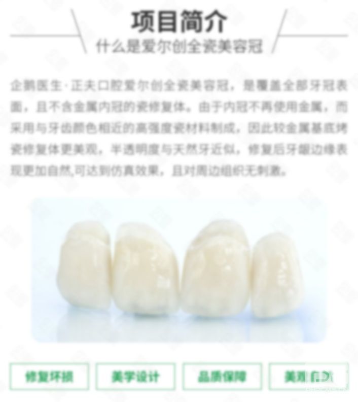愛爾創(chuàng)全瓷牙國產(chǎn)價(jià)格表,愛爾創(chuàng)全瓷牙的價(jià)格,愛爾創(chuàng)全瓷牙出廠價(jià)格