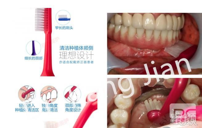 广州白云区牙科医院这十家,种植牙价目表新发布！