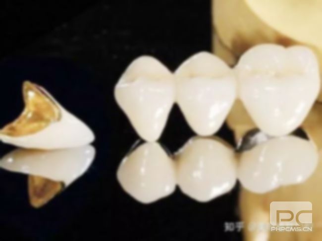 安裝牙冠后注意事項(xiàng),疼嗎?步驟