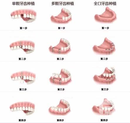 广州越秀区口腔医院权威榜单,广州越秀区在哪里看牙齿性价比最高?