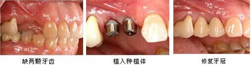 广州荔湾区口腔医院排行榜,广州荔湾区到哪里看牙齿性价比高?