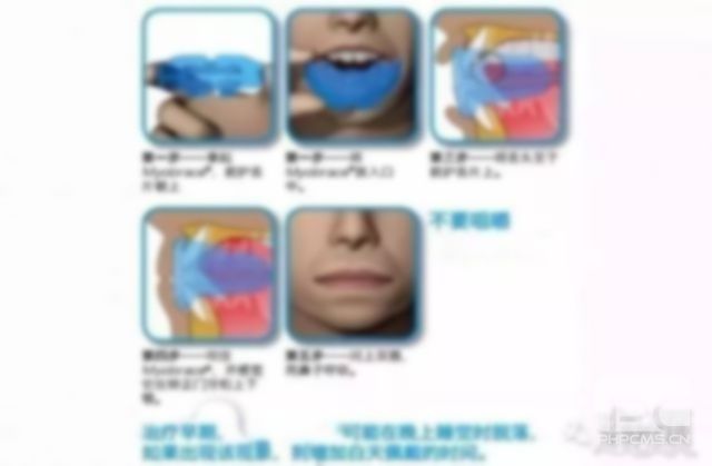 mrc牙齒矯正器,作用,矯正器效果好嗎?