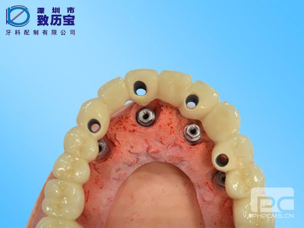 全新深圳光明區(qū)口腔醫(yī)院價(jià)目表全揭露,還等什么？收藏起來(lái)！