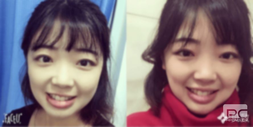 最年輕的假牙女,30歲滿口假牙女炎,20歲戴滿口假牙的女孩圖片