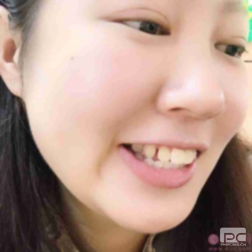 齙牙人圖片大全,小孩齙牙圖片,齙牙圖片真人圖片兒童 齙牙人圖片大全,小孩齙牙圖片,齙牙圖片真人圖片兒童