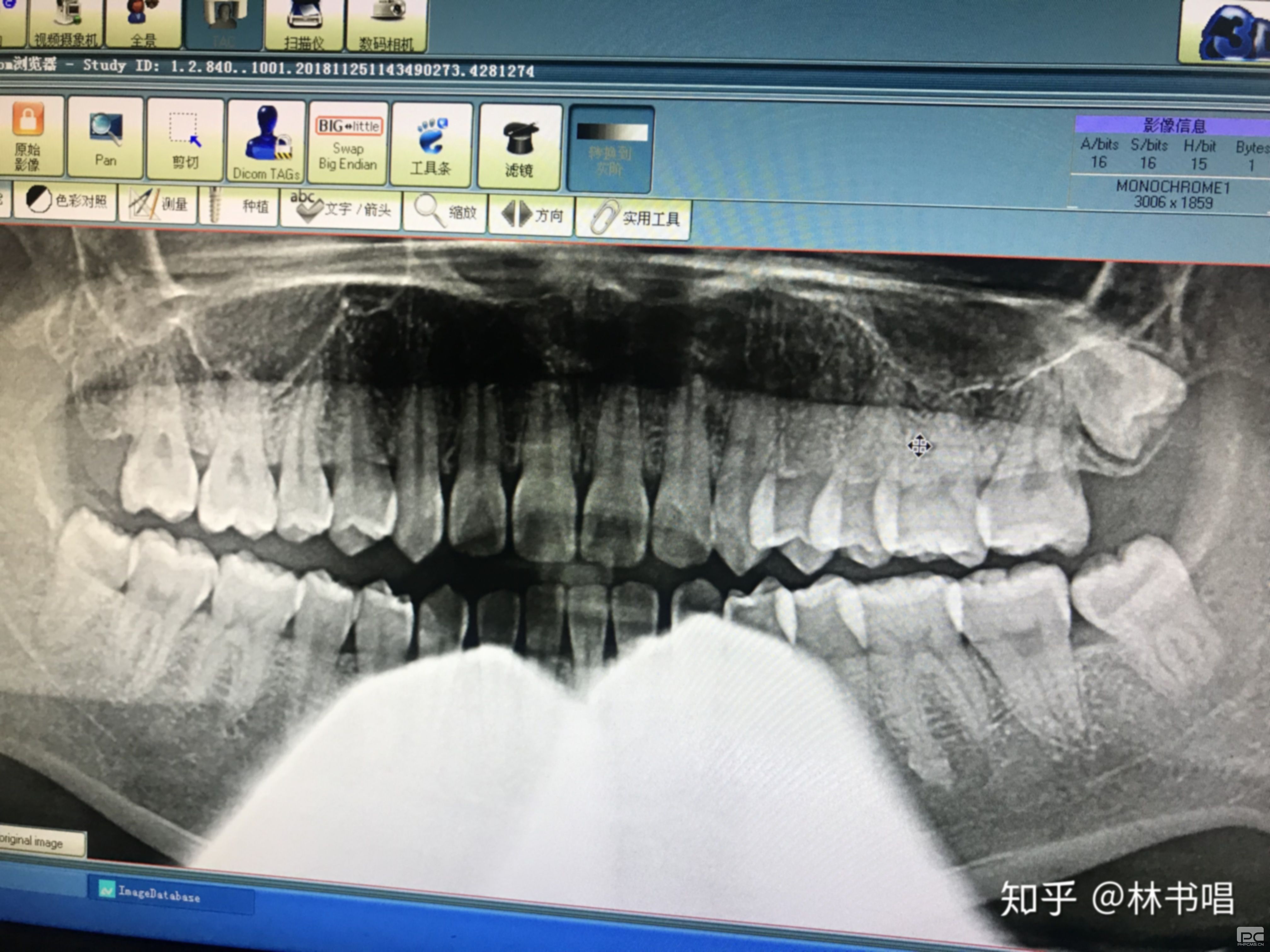 拔智齒在醫(yī)院拔還是牙醫(yī)診所便宜,去醫(yī)院還是診所,去醫(yī)院好還是牙科診所 拔智齒在醫(yī)院拔還是牙醫(yī)診所便宜,去醫(yī)院還是診所,去醫(yī)院好還是牙科診所