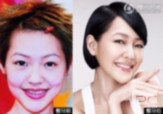 20歲以后整牙,還能整牙嗎?還可以整牙嗎? 20歲以后整牙,還能整牙嗎?還可以整牙嗎?