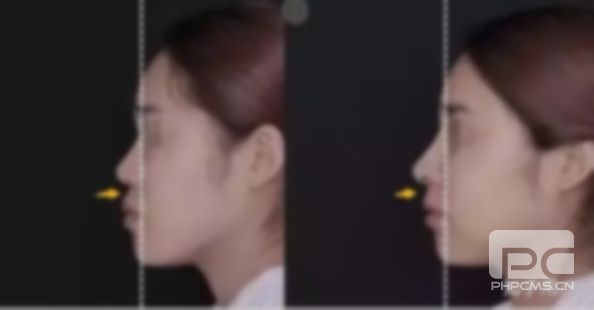 怎么才能改善凸嘴?樣改善凸嘴?改善凸嘴?? 怎么才能改善凸嘴?樣改善凸嘴?改善凸嘴??
