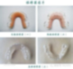 保持器可以戴一輩子嗎?戴保持器要戴一輩子嗎?牙套保持器要戴一輩子嗎? 保持器可以戴一輩子嗎?戴保持器要戴一輩子嗎?牙套保持器要戴一輩子嗎?