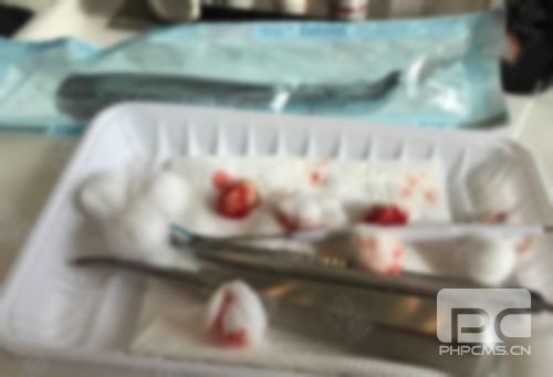 種植牙3800元是真的嗎?4000元會(huì)怎么樣?四千元左右可靠嗎?