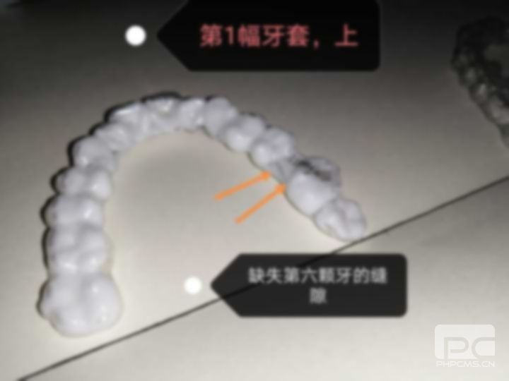 拔牙7天了還隱隱作痛不會(huì)沒有拔干凈吧,還有血,,有點(diǎn)腫 拔牙7天了還隱隱作痛不會(huì)沒有拔干凈吧,還有血,,有點(diǎn)腫