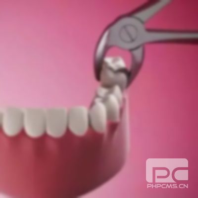 拔牙费用一般多少钱?一般收费多少?一般费用是多少?