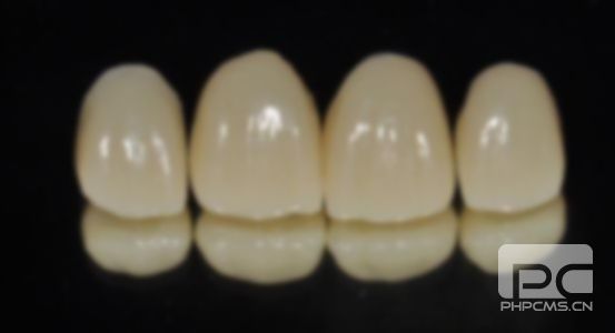 威蘭德全瓷牙和國(guó)產(chǎn)區(qū)別,3m全瓷牙和德國(guó)威蘭德區(qū)別,進(jìn)口威蘭德全瓷牙優(yōu)點(diǎn) 威蘭德全瓷牙和國(guó)產(chǎn)區(qū)別,3m全瓷牙和德國(guó)威蘭德區(qū)別,進(jìn)口威蘭德全瓷牙優(yōu)點(diǎn)
