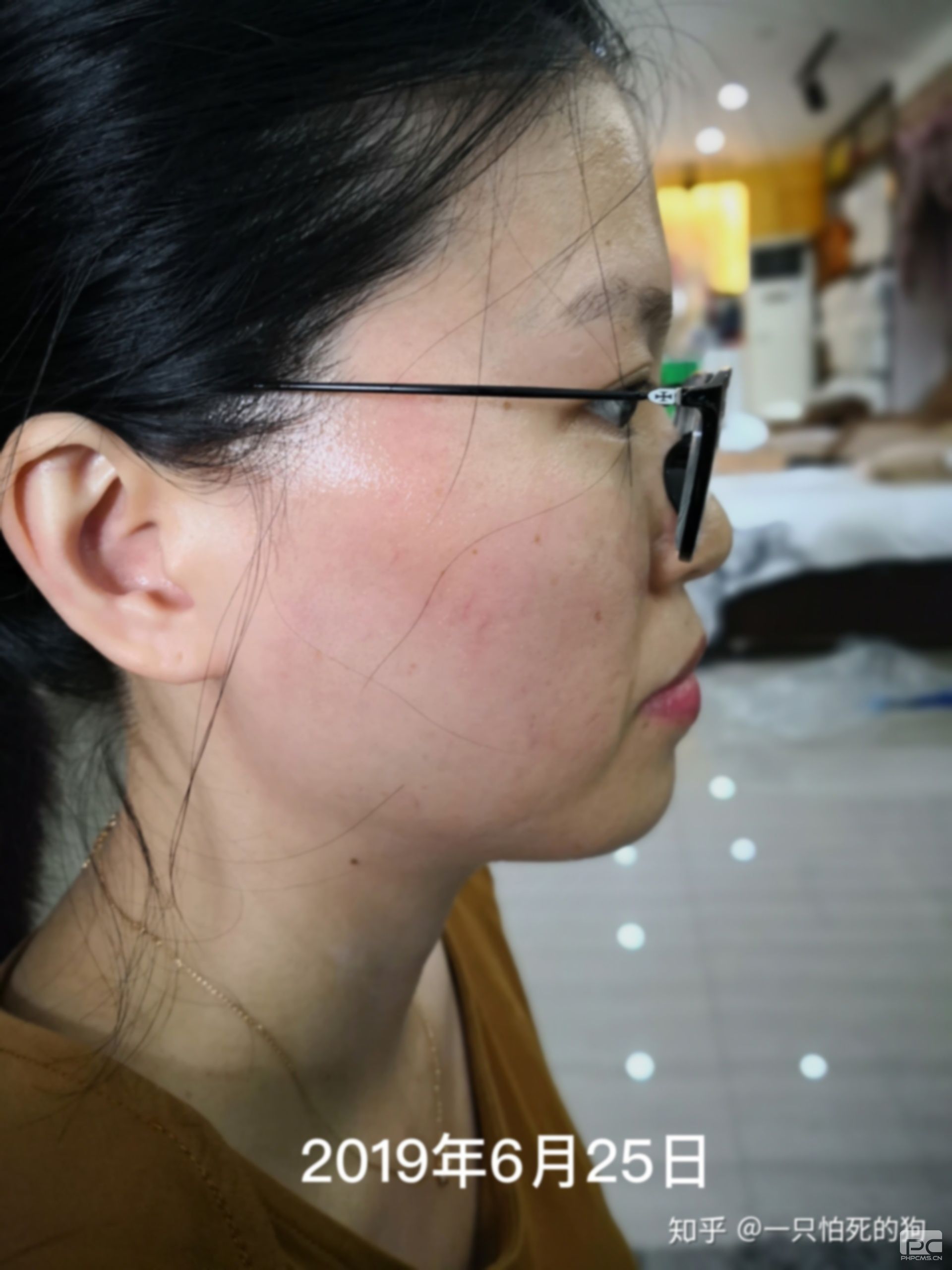 35歲了還要不要整牙,還有必要整牙嗎?想整牙 35歲了還要不要整牙,還有必要整牙嗎?想整牙