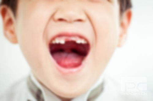 五歲兒童大牙蛀完了怎么補救?5歲兒童蛀牙已經(jīng)爛空了怎么辦?小孩蛀牙掉了怎么辦? 五歲兒童大牙蛀完了怎么補救?5歲兒童蛀牙已經(jīng)爛空了怎么辦?小孩蛀牙掉了怎么辦?