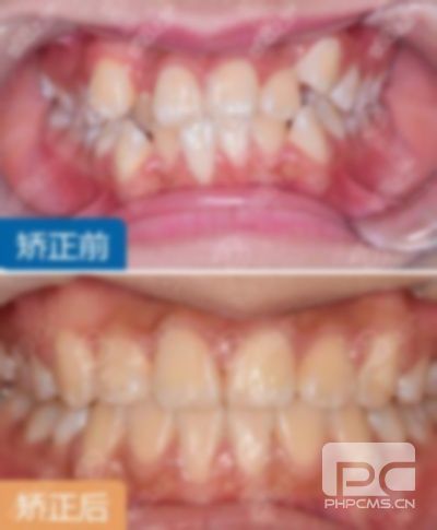 北海最好的口腔医院,牙科医院哪家最好,中医院牙科怎么样? 北海最好的口腔医院,牙科医院哪家最好,中医院牙科怎么样?