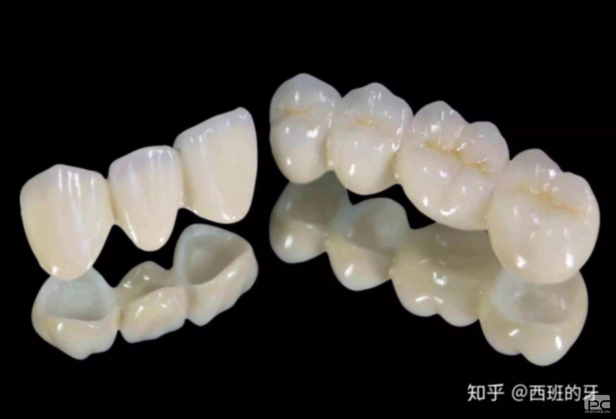 全瓷牙能矯正牙齒嗎?齙牙嗎?還能做矯正嗎? 全瓷牙能矯正牙齒嗎?齙牙嗎?還能做矯正嗎?