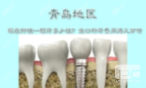 種植一顆牙要多少錢(qián)???需多少錢(qián)?? 種植一顆牙要多少錢(qián)???需多少錢(qián)??