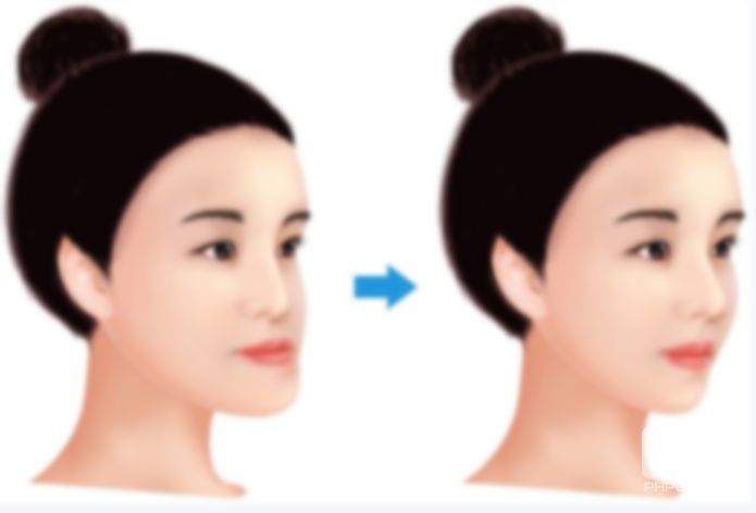 50歲能做牙齒矯正嗎?牙齒能矯正嗎?牙齒可以矯正嗎? 50歲能做牙齒矯正嗎?牙齒能矯正嗎?牙齒可以矯正嗎?