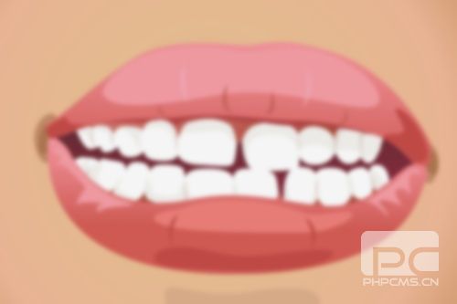 50歲了門牙縫越來越大怎么辦?門牙縫越來越寬,以后門牙有縫隙了怎么辦? 50歲了門牙縫越來越大怎么辦?門牙縫越來越寬,以后門牙有縫隙了怎么辦?